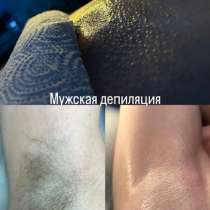 Депиляция, в г.Минск