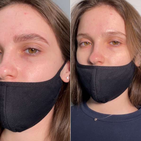 Комплекс бровей в Москве фото 3