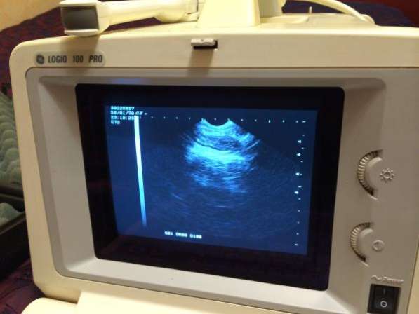 Logiq-100 в Москве